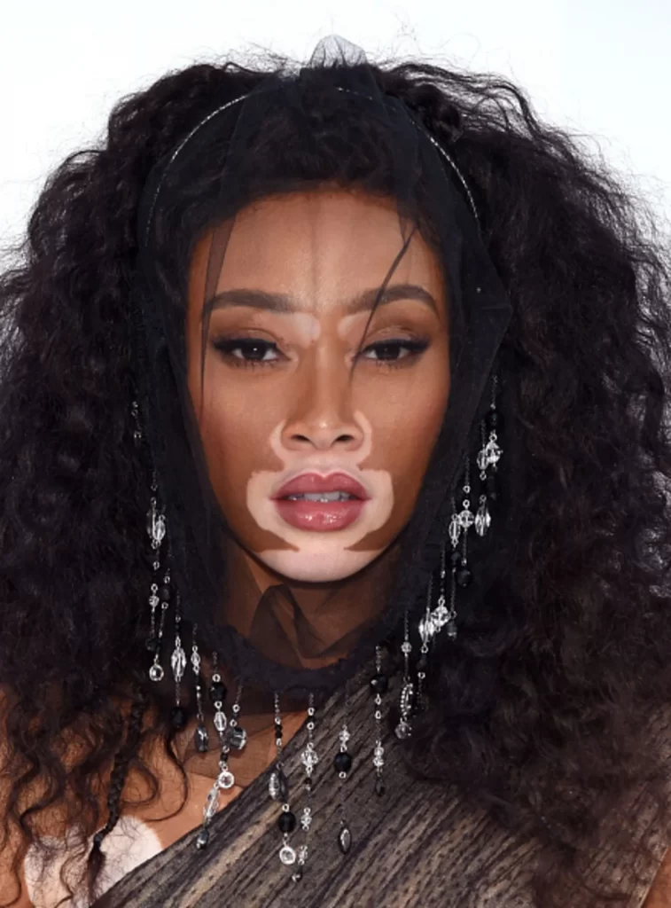 Winnie Harlow Net Worth 2021